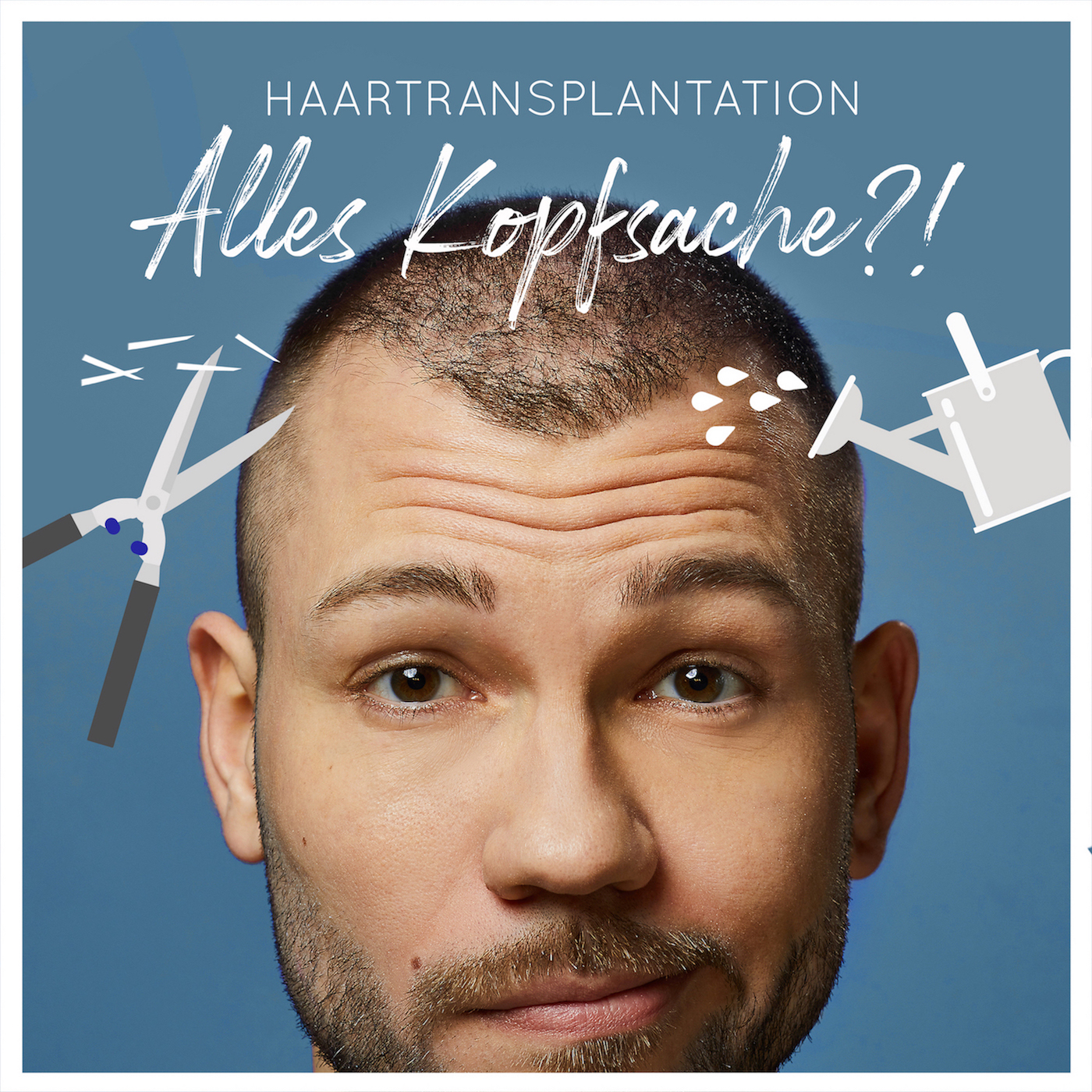 Haartransplantation - Alles Kopfsache?!